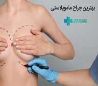 لیست بهترین جراحان زیبایی سینه یا ماموپلاستی ایران