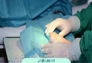 عمل جراحی سندروم تونل کارپال