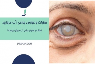 خطرات و عوارض جراحی آب مروارید