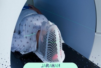 پرتو درمانی و شیمی درمانی بعد از عمل تومور مغزی چگونه است؟