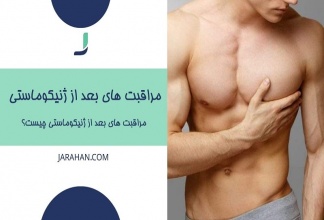 مراقبت های بعد از ژنیکوماستی