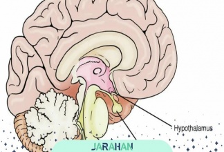 تومور غده هیپوتالاموس