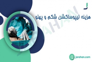 هزینه جراحی لیپوساکشن شکم و پهلو در تهران