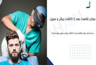 دوران نقاهت بعد از کاشت ریش و سبیل