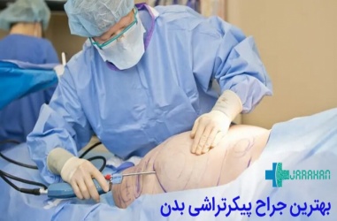 بهترین جراح پیکر تراشی در تهران