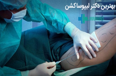 بهترین جراح لیپوساکشن در تهران و ایران
