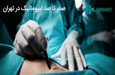عمل لیپوماتیک در تهران