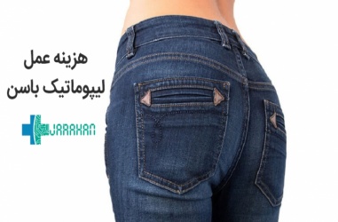 هزینه عمل لیپوماتیک باسن در تهران چقدر است؟