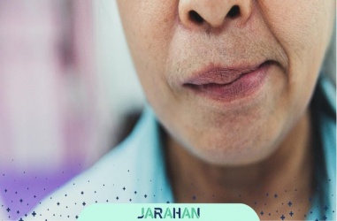 فلج نیمه صورت یا بلز چیست؟