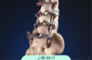 عمل فیوژن ستون فقرات و کمر چیست؟