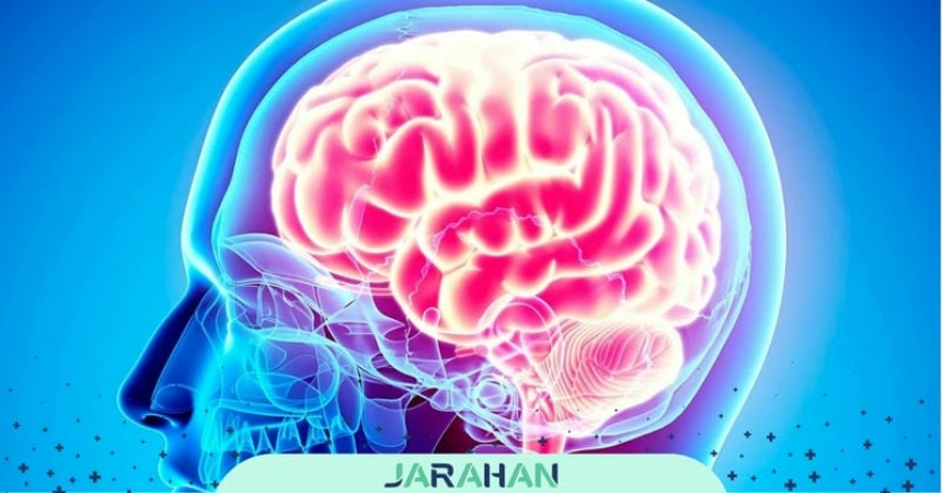 بیماری AVM مغزی چیست؟