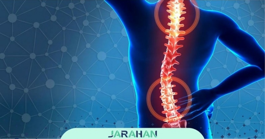 جراحی شکستگی ستون فقرات