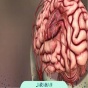 عوارض و خطرات عمل آنوریسم مغزی