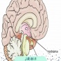 تومور غده هیپوتالاموس